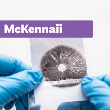 Impression de Spores Champignons Magiques | McKennaii